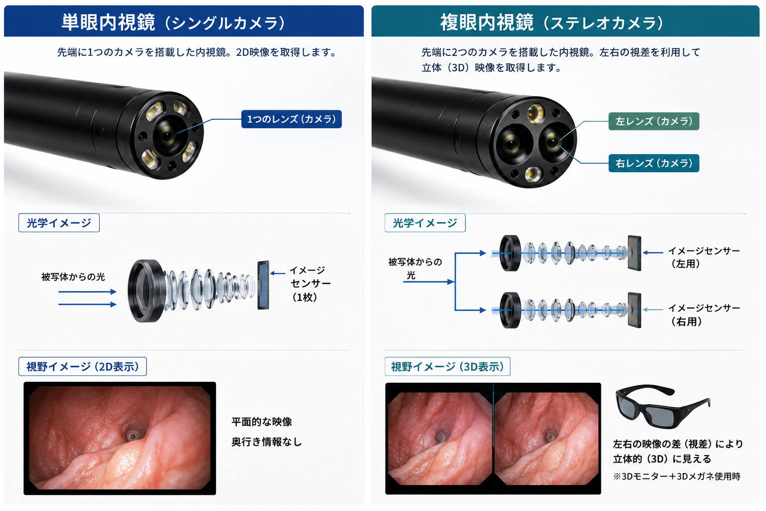Figure06.単眼内視鏡と複眼内視鏡の比較